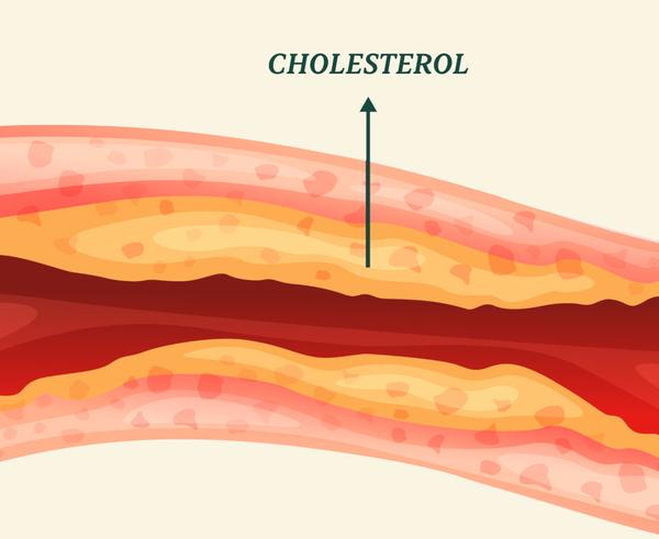9 Things You May Not Know About Cholesterol
