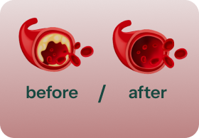 Vasodilation|b|Starts 30-60min