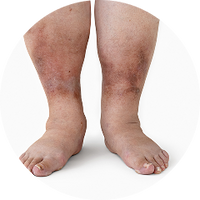 Excess Water Retention