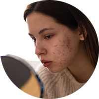 Skin Breakouts or Dullness